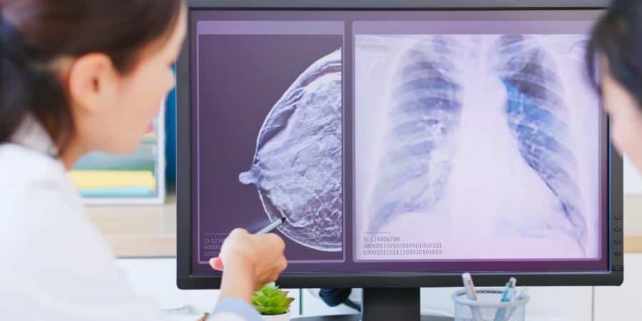 Imaging Technology for Breast Cancer
