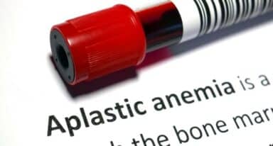 Fighting Aplastic Anemia
