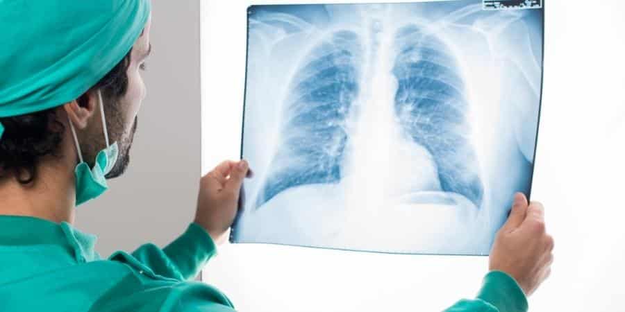 Early Detection of Lung Cancer – With 96% Less Radiation