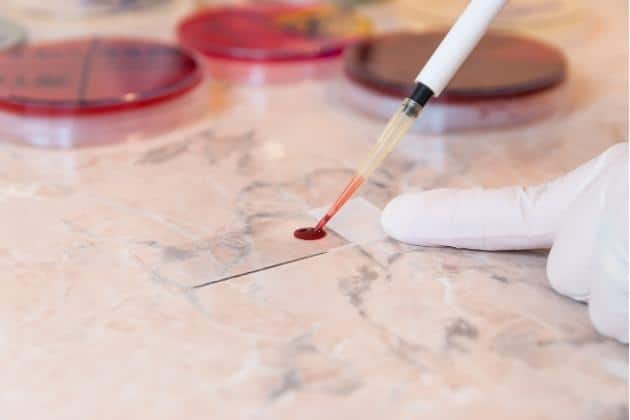blood test Hemophilia Gene Therapy in Israel