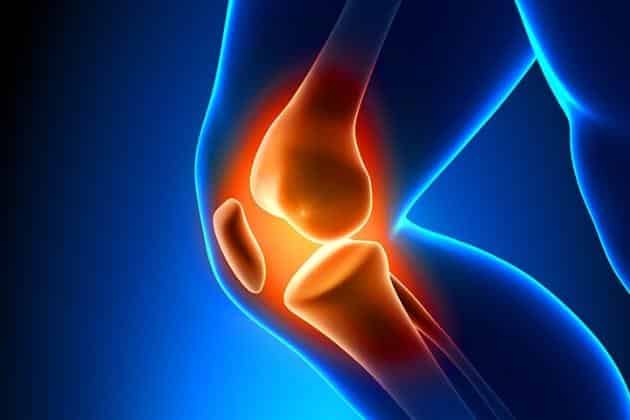 knee replacement in Israel