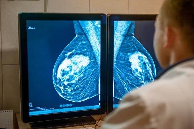 Breast Cancer Research in Israel: The Best the World Has to Offer