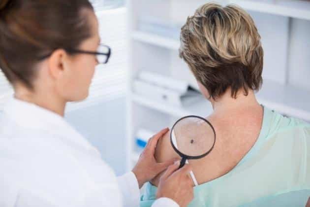 Melanoma and Skin Cancer Treatment in Israel